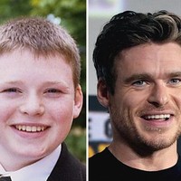 Richard Madden sukses jadi idola setelah penampilannya sebagai Robb Stark di Game of Thrones. Tapi dulu kehidupan remajanya jauh berbeda dari sekarang. Dulu badanku gemuk dan selalu dipermalukan. Aku mulai belajar akting untuk menambah kepercayaan diri, tuturnya, seperti dikutip dari Brightside. Foto: Dok. Brightside/istimewa