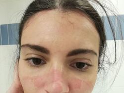 Foto Memilukan Tenaga Medis Sang Pejuang Terdepan Lawan Corona