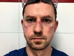 Foto Memilukan Tenaga Medis Sang Pejuang Terdepan Lawan Corona