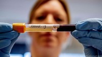 5 Cara Pencegahan Virus Corona, Mulai dari Diri Sendiri