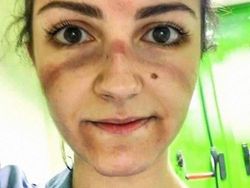 Foto Memilukan Tenaga Medis Sang Pejuang Terdepan Lawan Corona