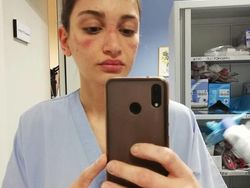 Foto Memilukan Tenaga Medis Sang Pejuang Terdepan Lawan Corona