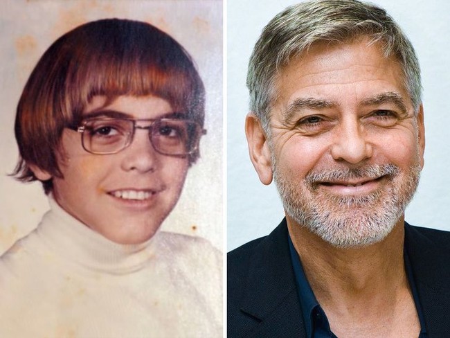 Saat SMP George Clooney mengalami Bells Palsy, suatu gangguan syaraf. Kondisi tersebut membuatnya sulit makan dan minum. Mata kirinya juga tidak bisa membuka selama setahun. Akibatnya dia di-bully dan dijuluki Frankenstein. Foto: Dok. Brightside/istimewa