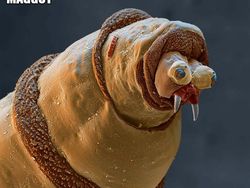 Ngeri atau Imut? Deretan Foto Makhluk Kecil Dilihat dari Microskop