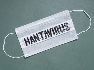 Pandemi Hantavirus Sudah Diprediksi Sejak 5 Tahun Lalu