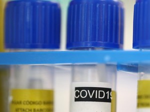 Perusahaan Jerman Bosch Luncurkan Alat Tes Cepat Virus Corona 2,5 Jam