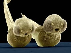 Ngeri atau Imut? Deretan Foto Makhluk Kecil Dilihat dari Microskop