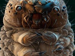 Ngeri atau Imut? Deretan Foto Makhluk Kecil Dilihat dari Microskop