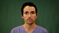 Dari wajah Luca Tarantino,37, yag merupakan seorang perawat di RS Humanitas Gavazzeni, Bergamo, terlihat jelas bekas luka dari alat pelindung diri (APD) yag dikenakannya. AP Photo/Antonio Calanni.
