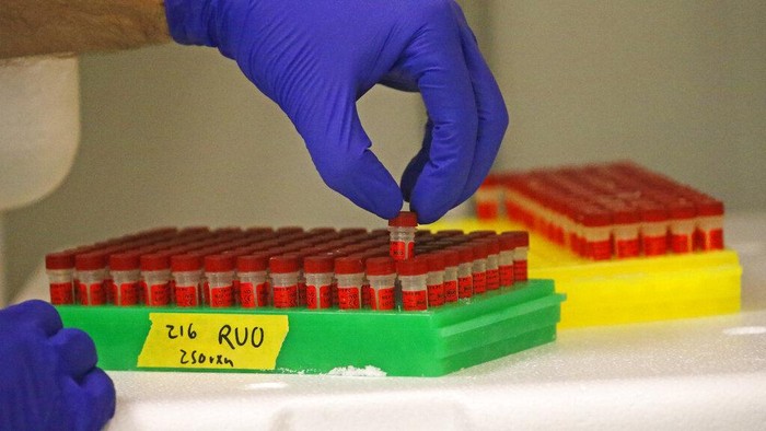 Ahli Sebut CT Scan Lebih Akurat Deteksi Virus Corona Dibanding Tes Swab