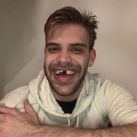 Pria ini harus hidup dengan kondisi giginya seperti di foto berikut ini. Covid-19 Shut Down The Dental School I Was Getting Work Done On For The Next Month. Wish Me Luck, tulisnya pada keterangan foto yang diunggahnya ke Reddit. Kata si pria virus corona membuat sekolah kedokteran tempat dia menjalani perawatan gigi harus ditutup. Dia pun harus hidup dengan kondisi gigi tersebut setidaknya selama sebulan ke depan. (Foto: Dok. Bored Panda)