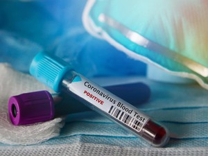 5 Isu Kesehatan Paling Dikepoin di 2020, Masker Scuba hingga Gejala Corona