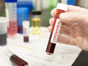 Kasus Positif Virus Corona di Timika Papua Bertambah Jadi 8