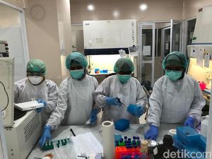 Butuh Waktu 8 Jam untuk Periksa Sampel Corona, Begini Tahapannya