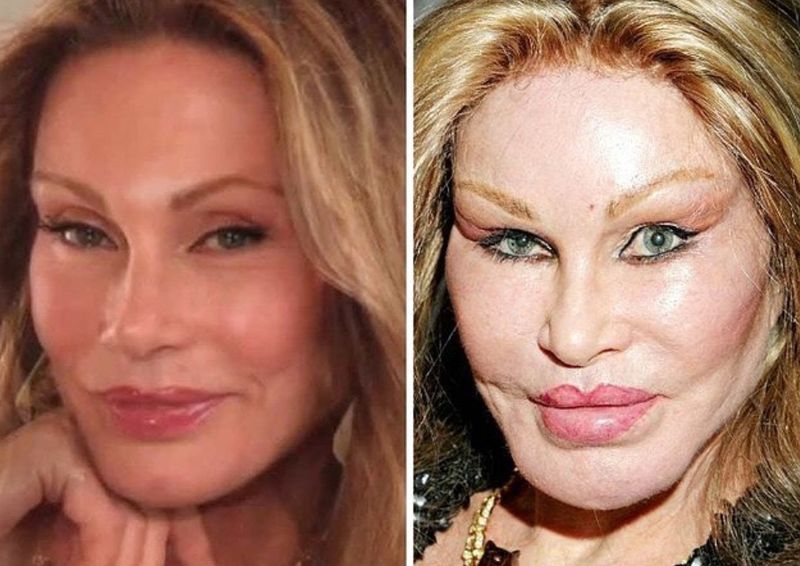 Jocelyn Wildenstein
