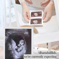 Kehamilan pertama Dian Wahyu Utami atau lebih dikenal dengan nama Dian Pelangi, ini melengkapi kebahagiannya bersama dengan suaminya, Sandy Nasution yang menikah pada 17 November 2019. Foto: Instagram Story @dianpelangi