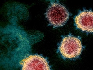 Uni Eropa Desak Pembatasan Penggunaan Obat Malaria Untuk Obati COVID-19