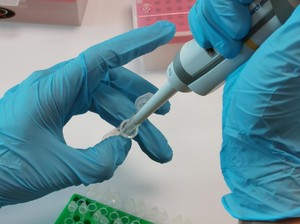 Persentase Kasus Positif Corona RI 19%, Malaysia-Korsel Lebih Rendah