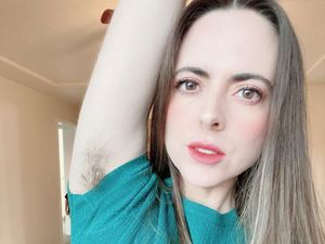 Wanita yang Kini Suka Pamer Bulu Ketiak, Dulu Dibilang Kumisan Oleh Pacar