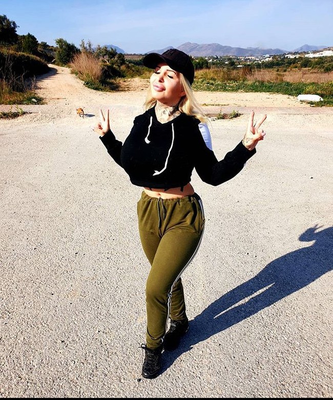 Wanita berusia 28 tahun ini tak masalah menahan rasa sakit yang dideritanya karena operasi plastik. Ia juga tak mempedulkan berapa banyak biaya yang dihabiskannya demi penampilan plastik-nya Foto: Instagram