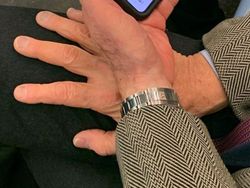 Bermacam Cara agar Tangan Tak Sentuh Benda