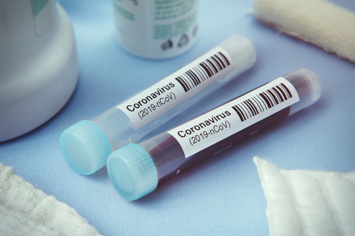Detail of coronavirus test tubes