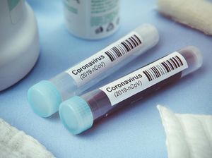 Peneliti Sebut Virus Corona Bisa Serang Kekebalan Tubuh Seperti HIV