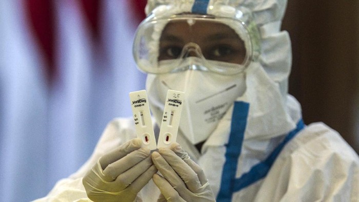 DPP GOLKAR SELENGGARAKAN RAPID TEST Petugas medis mengambil sampel darah saat rapid test atau pemeriksaan cepat COVID-19 di DPP Golkar, Slipi, Jakarta, Selasa (7/4/2020). Partai Golkar menyelenggarakan rapid test COVID-19 secara gratis bagi wartawan, kader, dan masyarakat guna memastikan kesehatan dan mengantisipasi penyebaran COVID-19. ANTARA FOTO/Didik Setiawan/gp/hp.