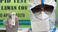 Petugas kesehatan menunjukkan hasil rapid tes yang negatif COVID-19.