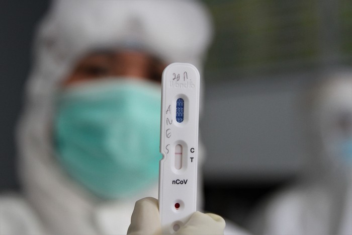 Petugas medis menunjukan rapid test atau pemeriksaan cepat COVID-19 yang diambil dari salah satu sampel darah jurnalis di Kantor Dinas Komunikasi dan Informatika Provinsi Sulawesi Tenggara, Kendari, Sulawesi Tenggara, Selasa (07/4/2020). Pihak Dinas Komunikasi dan Informatika Provinsi Sulawesi Tenggara bekerja sama dengan Ahli Teknologi Laboratorium Medik (ATLM) Kendari melakukan pemeriksaan rapid test kepada para jurnalis di Kendari sebab berpotensi terpapar virus COVID-19 saat melakukan peliputan. ANTARA FOTO/Jojon/foc.