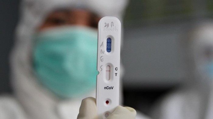 RAPID TEST JURNALIS DI KENDARI Petugas medis menunjukan rapid test atau pemeriksaan cepat COVID-19 yang diambil dari salah satu sampel darah jurnalis di Kantor Dinas Komunikasi dan Informatika Provinsi Sulawesi Tenggara, Kendari, Sulawesi Tenggara, Selasa (07/4/2020). Pihak Dinas Komunikasi dan Informatika Provinsi Sulawesi Tenggara bekerja sama dengan Ahli Teknologi Laboratorium Medik (ATLM) Kendari melakukan pemeriksaan rapid test kepada para jurnalis di Kendari sebab berpotensi terpapar virus COVID-19 saat melakukan peliputan. ANTARA FOTO/Jojon/foc.