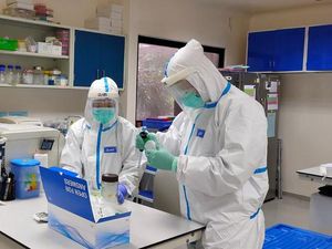 Dewan Dorong Pemkab Sumedang Punya Fasilitas Lab Uji PCR