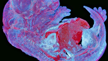 Pemenang region Asia Pasifik diraih Alan Prescott (Inggris) menampilkan  Howard Vindin (Australia).  Gambar yang luar biasa ini menunjukkan autofluoresensi embrio tikus. Foto: Olympus Image of the Year 2019