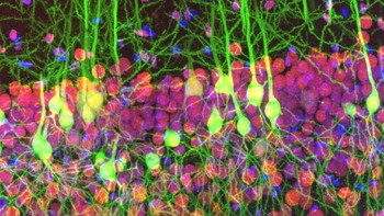 Pemenang Global diriah Ainara Pintor. Menampilkan gambar fluoresensi  menakjubkan yang menunjukkan imunostaining irisan otak tikus. Foto: Olympus Image of the Year 2019