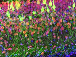 Deretan Jawara Foto Mikroskop yang Mencengangkan Mata