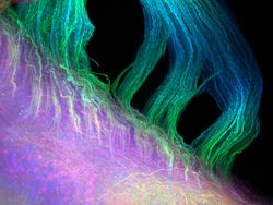 Deretan Jawara Foto Mikroskop yang Mencengangkan Mata