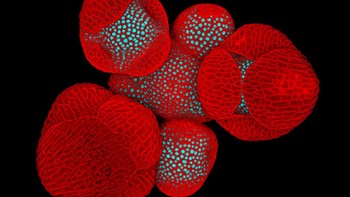 Honorable Mentions - karya Nat Prunet dari AS. Menampilkan bakal bunga arabidopsis thaliana Foto: Olympus Image of the Year 2019