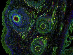 Deretan Jawara Foto Mikroskop yang Mencengangkan Mata