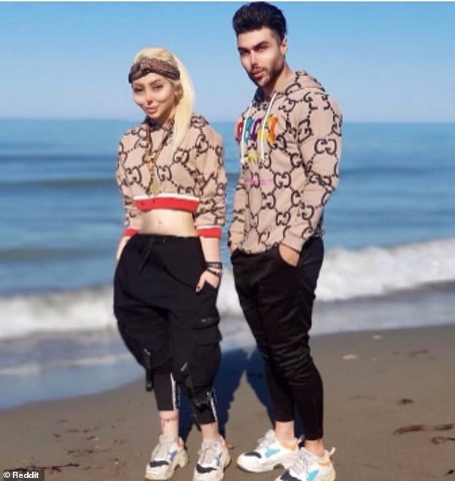 Untuk menyempurnakan gaya kembaran mereka, pasangan ini juga memiliki garis rahang yang agak janggal. (Foto: Instagram)