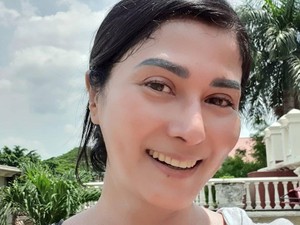 Cerita Tamara Geraldine Divonis Pengerasan Hati hingga Siapkan Pemakaman