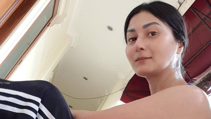 4 Fakta Sirosis Hati, Diidap Tamara Geraldine sampai Divonis Sisa Hidup 8 Bulan