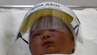 Pemakaian pelindung muka itu untuk mencegah terjadinya penularan virus terhadap bayi di tengah pandemi Corona (COVID-19).