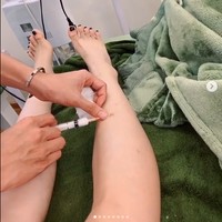 Pemilik klinik lalu menawarkan Mai untuk menghilangkan luka dengan perawatan yang diklaim seharga 1,5 juta dong atau Rp 990 ribuan. Mai menyetujuinya lalu filler disuntikkan di bagian kaki yang digigit nyamuk itu. Foto: Instagram @suongsyn