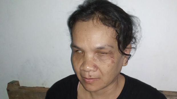Tukang pijat tunanetra di Tangerang yang berjuang di tengah wabah Corona