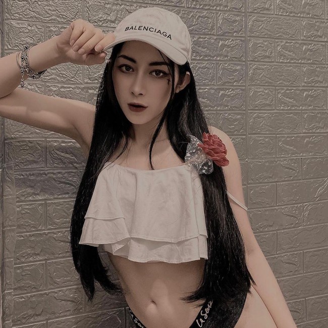 Setelah bekas gigitan nyamuknya disuntik filler oleh pemilik klinik, Mai mendapati ada celah cekung di sekitar bagian tersebut. Kakinya juga menjadi biru hingga lemah dari pada kaki yang satunya. Foto: Instagram @suongsyn