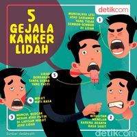 6 Tandatanda Yg Wajib  Dikenali Kanker Lidah Yg Tidak Sanggup