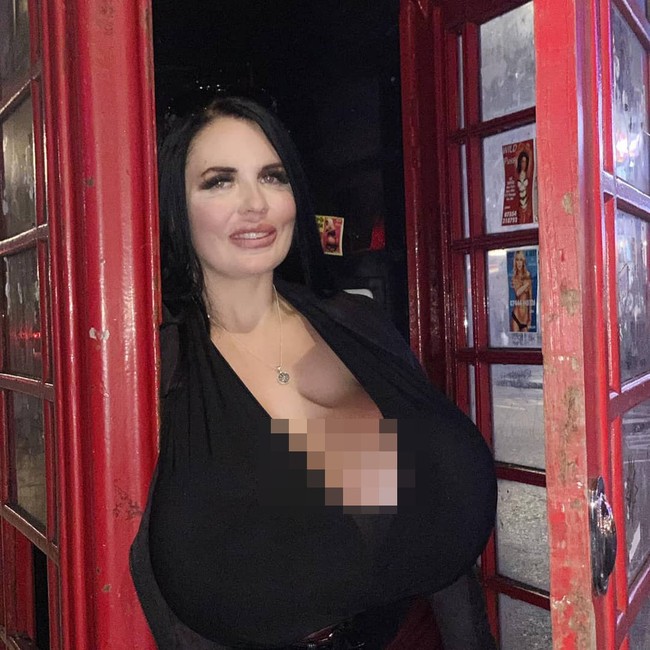 Dr. Paul Nassif memperingati Foxy bahwa tindakannya tersebut bisa berbahaya. Saat pasien melakukan transfer lemak ke bokong lalu melakukan transfer lemak lagi, hal tersebut bisa berisiko terjadinya infeksi, ujar Dr. Paul.  Foto: Instagram