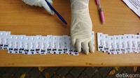 Pemerintah menyediakan 700 alat rapid test untuk screening awal COVID-19.