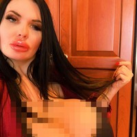 Seperti dikutip dari The Sun, Foxy menyuntikkan payudaranya dengan cairan infus saline di rumah. Ia ingin memastikan bahwa dadanya tetap besar.  Foto: Instagram