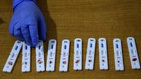 Warga yang melakukan rapid test diambil sampel darahnya sementara untuk swab test menggunakan sampel lendir. ANTARA FOTO/Abriawan Abhe.